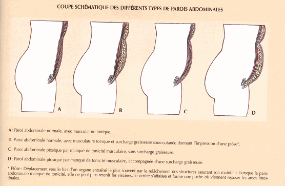 les_differents_ventres