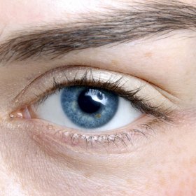 5 raisons pour lesquelles vous avez des poches sous les yeux