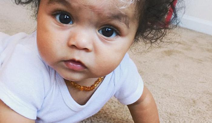 Cette petite fille est née avec la même mèche de cheveux blancs que sa maman | #5