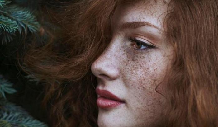 13 personnes magnifiques et remarquables grâce à la beauté unique de leurs taches de rousseur | #9