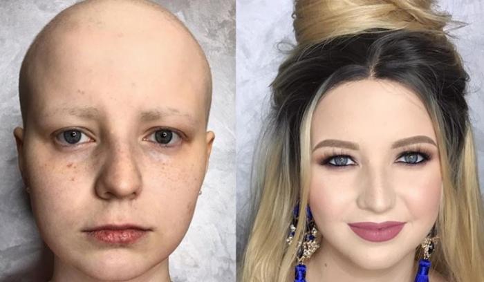 Cette make-up artiste transforme les femmes malades, cancéreuses ou brûlées grâce au maquillage pour leur redonner confiance en elles