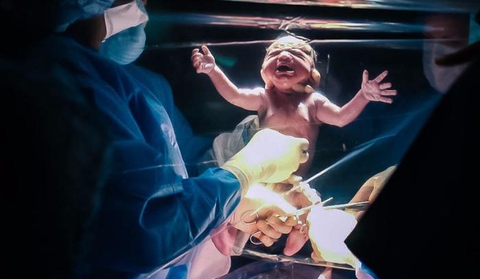 Vous n'avez jamais vu de photos d'accouchement par césarienne aussi belles que celles-ci