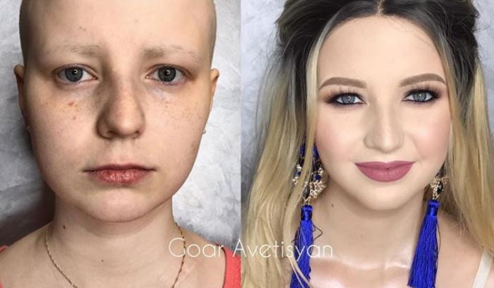 Cette make-up artiste transforme les femmes malades, cancéreuses ou brûlées grâce au maquillage pour leur redonner confiance en elles | #2