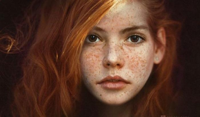 13 personnes magnifiques et remarquables grâce à la beauté unique de leurs taches de rousseur | #11