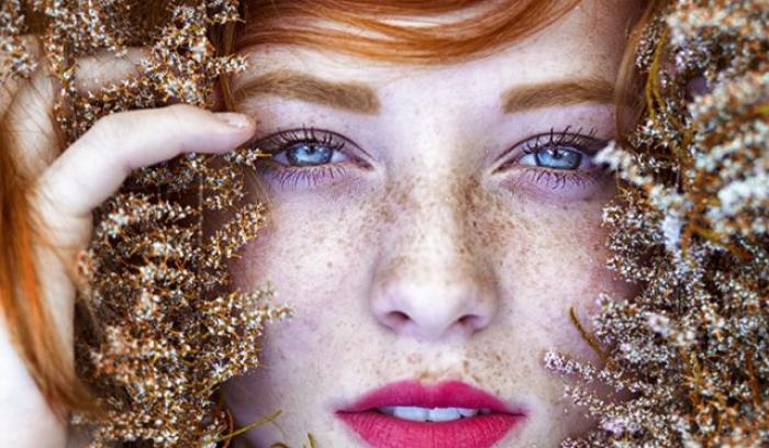 13 personnes magnifiques et remarquables grâce à la beauté unique de leurs taches de rousseur | #8