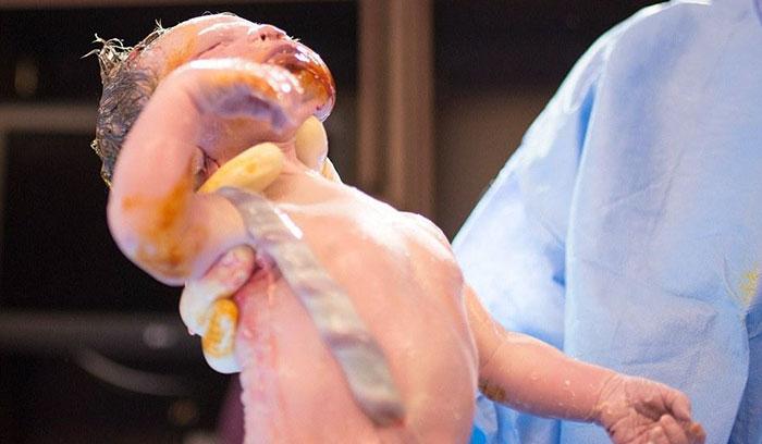 Cette maman photographie son propre accouchement : le résultat est vraiment magnifique | #9