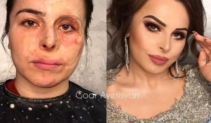 Cette make-up artiste transforme les femmes malades, cancéreuses ou brûlées grâce au maquillage pour leur redonner confiance en elles | #3