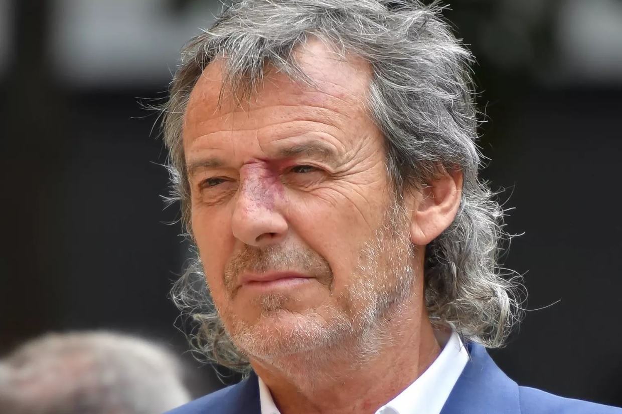 Il est mort : cette phrase bouleversante entendue par Jean-Luc Reichmann après son accident de moto
